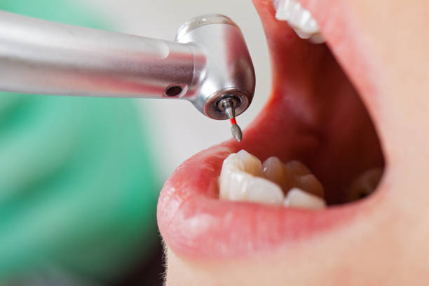 Best Pediatric Emergency Dentist in Baltimore, OH